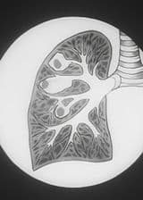 Preventing Tuberculosis